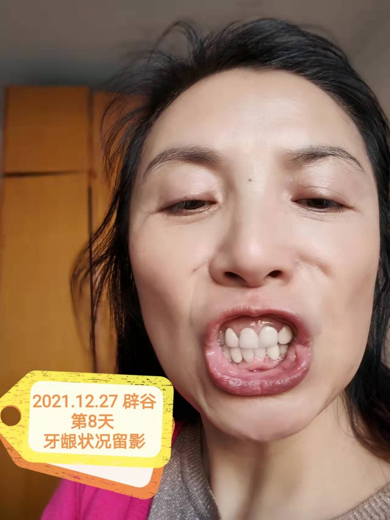 2021.12.27 �ٹȵ�8�� ����״��.jpg