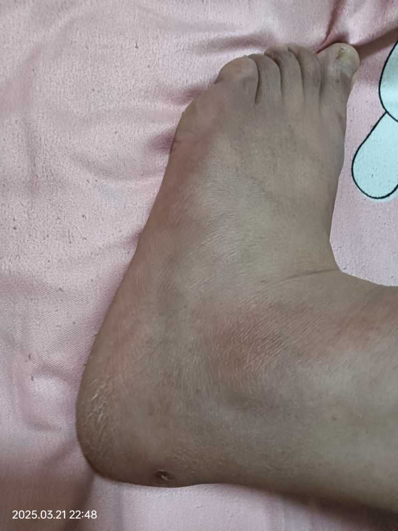 IMG20250321224826.jpg
